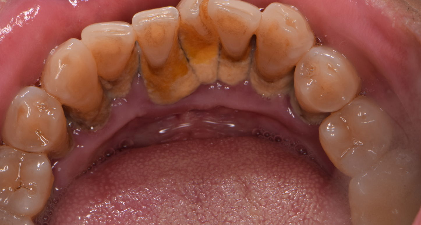 良好な口腔衛生を実践する